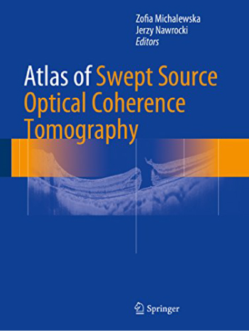 Atlas of Swept SourceOptical Coherence Tomography