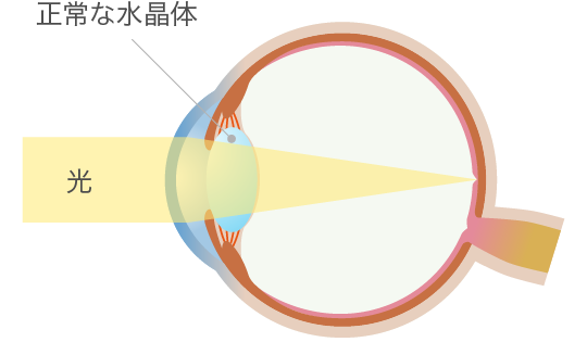 正常な水晶体