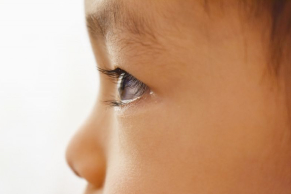 小児眼科（弱視・斜視）